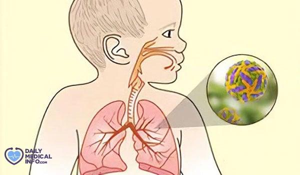 فيروس الجهاز التنفسي المخلوي Rsv فيروس تنفسي جديد، والأطفال أكثر عرضة للإصابة فانتبهوا!