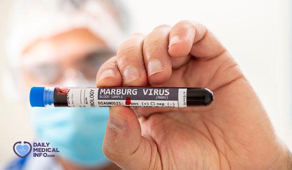 منظمة الصحة العالمية تنظم اجتماع عاجل لتسريع تطوير لقاح فيروس ماربورغ